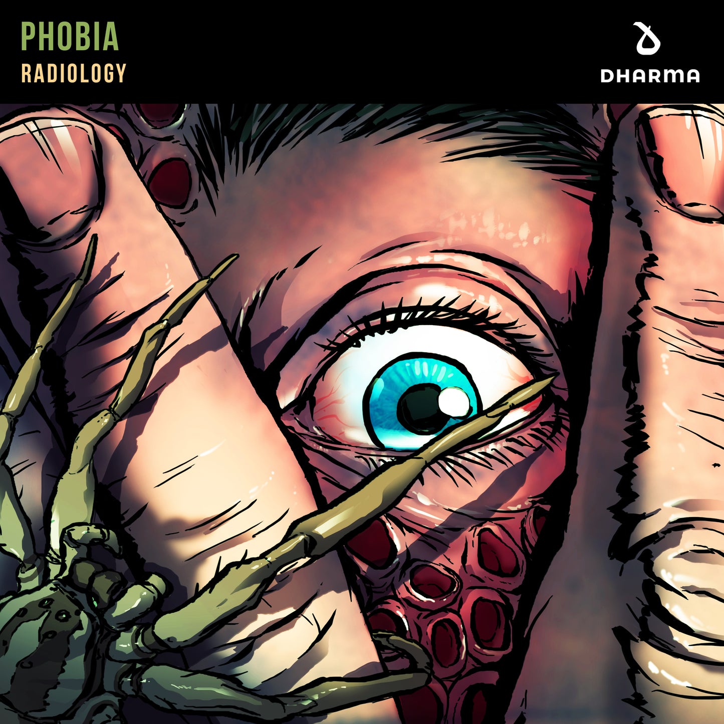 Radiology - Phobia (Dharma/Spinnin')